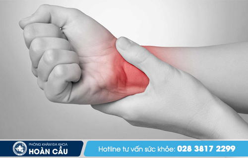 Bong gân cổ tay có nhiều mức độ và triệu chứng khác nhau
