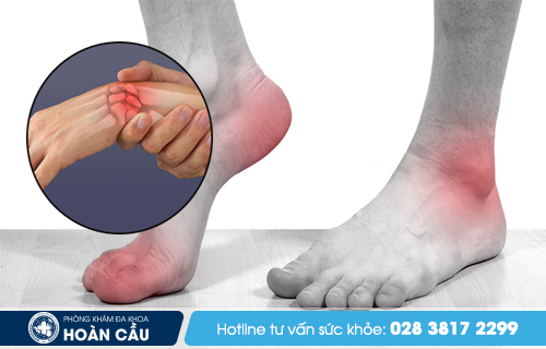 Tình trạng chấn thương tay có thể khiến người bệnh bị đau nhức tay chân về đêm