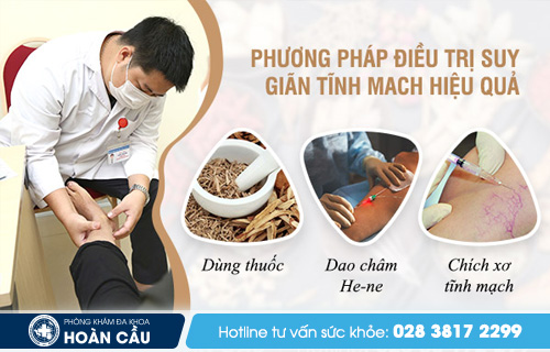 Phân tích bệnh giãn tĩnh mạch của Hoàn Cầu Gian-tinh-mach-chan-nguyen-nhan-va-nhung-bien-chung-nguy-hiem1