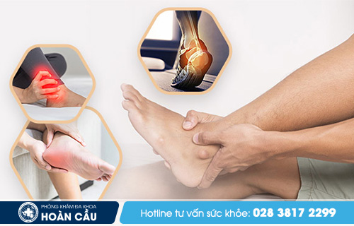 Nguyên nhân gây đau lòng bàn chân - Đa khoa Hoàn Cầu  Ngu-day-dau-long-ban-chan-la-bi-benh-gi3