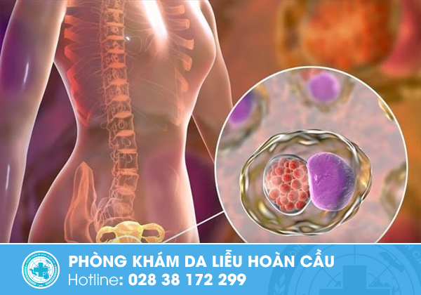 Dấu hiệu mắc bệnh lây qua đường tình dục - Đa khoa Hoàn Cầu  Phong-kham-da-khoa-hoan-cau-chia-se-benh-lay-qua-duong-tinh-duc-dau-hieu-va-cach-ngua-1