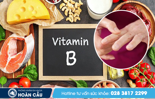 Thiếu hụt vitamin nhóm B có thể gây ra tình trạng tê bì các ngón tay